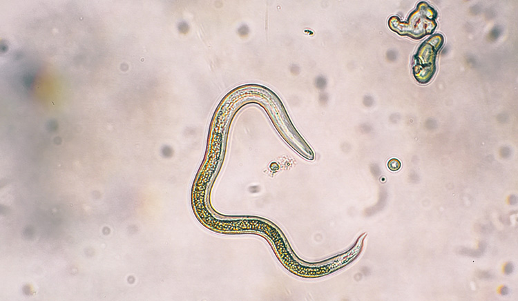 Roundworm seen under a micrscope