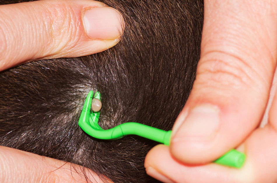 Removing a tick from a pet using a tick remover